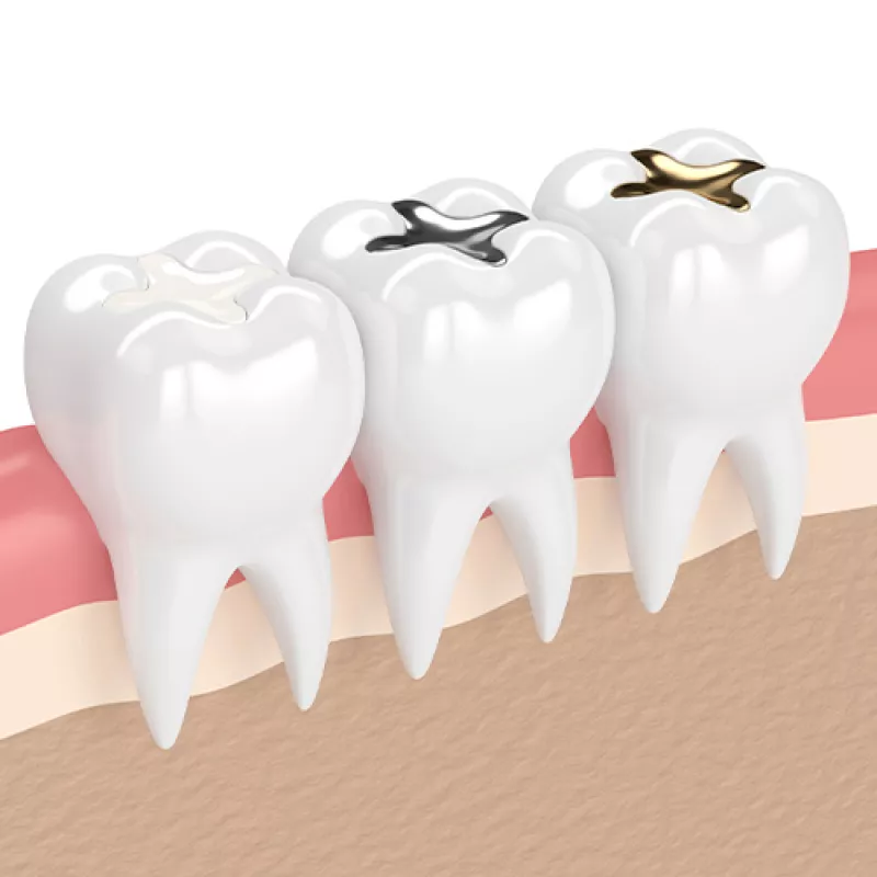 Záchovná stomatologie